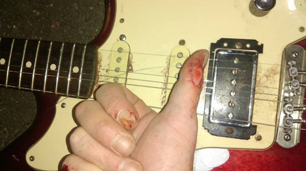 Guitar bloody fingers deals